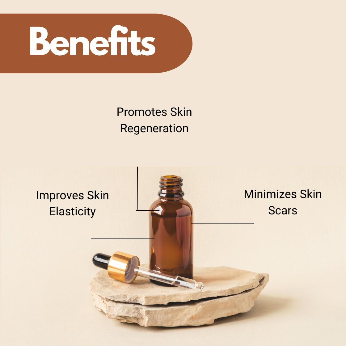  Frankincense essential oil in dark glass bottle with dropper, boswellia oil for promoting skin regeneration, improving skin elasticity and minimizing skin scars.